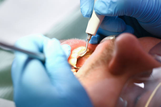 Best Root Canal Emergency Dentist  in South Point, OH