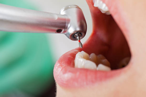 Best Dentist for Tooth Abscess  in South Point, OH